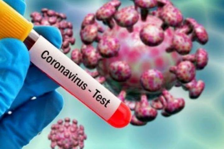 عدم شناسایی وسیع افراد از دلایل افزایش شیوع کرونا در کشور عدم شناسایی وسیع افراد از دلایل افزایش شیوع کرونا در کشور است