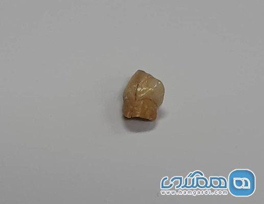 جستجو درباره اطلاعات تکمیلی دندان نئاندرتال کرمانشاه